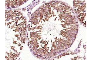 Immunohistochemistry (Paraffin-embedded Sections) (IHC (p)) image for anti-Heat Shock Protein 90kDa alpha (Cytosolic), Class A Member 2 (HSP90AA2) (AA 401-500) antibody (ABIN1714199)
