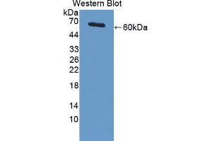 Western blot analysis of the recombinant protein. (PIAS3 Antikörper  (AA 11-280))