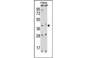 Western blot analysis of HYAL2 / Hyaluronidase-2 Antibody (Center) Cat. (HYAL2 Antikörper  (Middle Region))