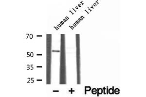 Western blot analysis of extracts of human liver tissue, using TRIM44 antibody.
