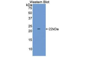 Western blot analysis of the recombinant protein. (LAMC2 Antikörper  (AA 28-196))