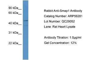 WB Suggested Anti-LOC684800  Antibody Titration: 0. (SMAP1 Antikörper  (N-Term))