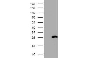 Western Blotting (WB) image for anti-Hydroxysteroid (17-Beta) Dehydrogenase 8 (HSD17B8) (AA 57-261) antibody (ABIN2715556)