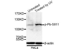 Western blot analysis of extracts of 293 and HeLa cells, using Phospho-Rb-S811 antibody. (Retinoblastoma 1 Antikörper  (pSer811))