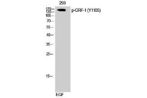 Western Blotting (WB) image for anti-Glucocorticoid Receptor DNA Binding Factor 1 (GRLF1) (pTyr1105) antibody (ABIN3182521) (GRLF1 Antikörper  (pTyr1105))