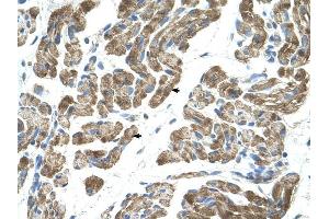 Immunohistochemistry (IHC) image for anti-Activin Receptor Type I (ACRV1) (N-Term) antibody (ABIN635876)