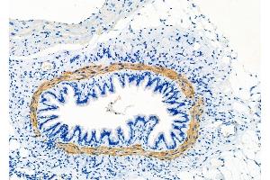 ABIN6260910 and ABIN6277858 at 1/100 staining Rat lung tissue by IHC-P. (Calponin Antikörper  (N-Term))