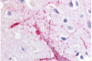 Immunohistochemistry (Paraffin-embedded Sections) (IHC (p)) image for anti-G Protein-Coupled Receptor, Family C, Group 5, Member B (GPRC5B) (C-Term) antibody (ABIN213465)