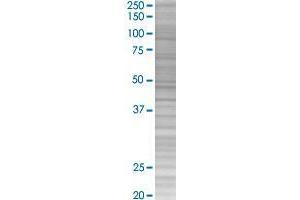 RNF12 transfected lysate.