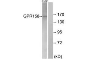 Western Blotting (WB) image for anti-G Protein-Coupled Receptor 158 (GPR158) (AA 1-50) antibody (ABIN2890856) (GPR158 Antikörper  (AA 1-50))