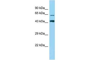 Western Blotting (WB) image for anti-Zinc Finger Protein 667 (ZNF667) (N-Term) antibody (ABIN2778606) (ZNF667 Antikörper  (N-Term))