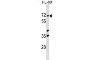 Western Blotting (WB) image for anti-Calicin (CCIN) antibody (ABIN2999591) (Calicin Antikörper)