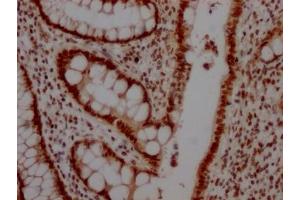 Immunohistochemistry (IHC) image for anti-Topoisomerase (DNA) I (TOP1) antibody (ABIN7127850)