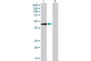 Western Blot analysis of SLC7A7 expression in transfected 293T cell line by SLC7A7 MaxPab polyclonal antibody. (SLC7A7 Antikörper  (AA 1-511))
