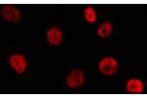 ABIN6275788 staining 293T by IF/ICC. (SUV39H2 Antikörper  (Internal Region))