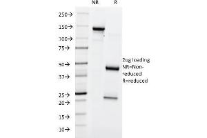 SDS-PAGE Analysis Purified Lewis Y Mouse Monoclonal Antibody (A70-A/A9). (Blood Group Lewis Y Antikörper)