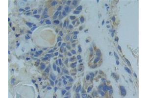 Immunohistochemistry (IHC) image for anti-Tumor Necrosis Factor Receptor Superfamily, Member 1A (TNFRSF1A) (AA 248-428) antibody (ABIN7442288)