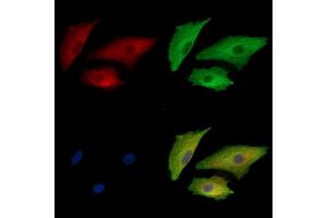 ABIN7095079 and ABIN7099135 staining  cells by IF/ICC.