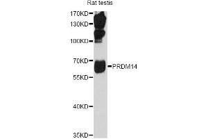 Western blot analysis of extracts of rat teatis, using PRDM14 antibody (ABIN1876766) at 1:1000 dilution. (PRDM14 Antikörper)