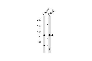 Western blot analysis of lysates from Ramos, Daudi cell line (from left to right), using TEC Antibody (Center) (ABIN6242484 and ABIN6577833). (NR4A3 Antikörper  (AA 254-288))