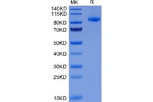 SDS-PAGE (SDS) image for EPH Receptor A2 (EPHA2) (AA 24-534) protein (Fc Tag) (ABIN7274550)