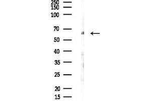 anti-SNW Domain Containing 1 (SNW1) antibody