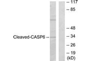 Western blot analysis of extracts from 293 cells, treated with Etoposide 25uM 60', using Caspase 6 (Cleaved-Asp162) Antibody. (Caspase 6 Antikörper  (Cleaved-Asp162))