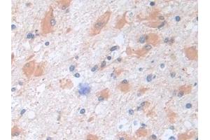 Immunohistochemistry (IHC) image for anti-serpin Peptidase Inhibitor, Clade B (Ovalbumin), Member 9 (SERPINB9) (AA 1-376) antibody (ABIN7435502)