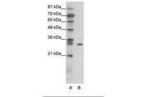 Image no. 1 for anti-NF-kappa-B inhibitor beta (NFKBIB) (AA 49-98) antibody (ABIN6736066) (NFKBIB Antikörper  (AA 49-98))