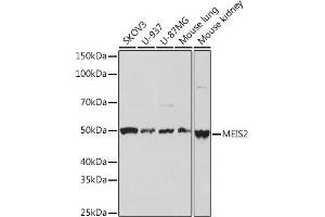 Western blot analysis of extracts of various cell lines, using MEIS2 Rabbit mAb (ABIN7268450) at 1:1000 dilution.
