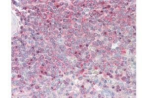 Anti-MSN / Moesin antibody IHC staining of human spleen. (Moesin Antikörper  (AA 292-491))