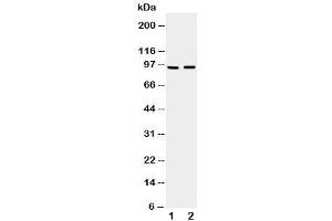 Western blot testing of ADAMTS4 antibody and Lane 1:  rat brain (ADAMTS4 Antikörper  (C-Term))