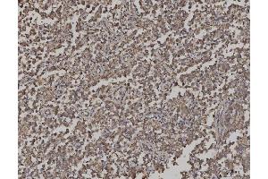 IHC analysis of ARL13B using anti-ARL13B antibody (ABIN7600179). (ARL13B Antikörper  (AA 16-428))