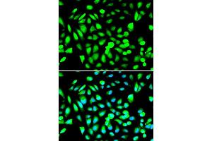 Immunofluorescence analysis of A549 cell using PRMT5 antibody. (PRMT5 Antikörper)