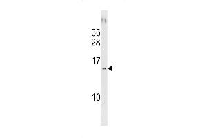 SD13 Antibody (C-term) (ABIN1881772 and ABIN2843204) western blot analysis in NCI- cell line lysates (35 μg/lane). (SAMD13 Antikörper  (C-Term))