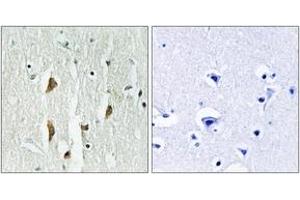 Immunohistochemistry analysis of paraffin-embedded human brain tissue, using PAK1/2/3 (Ab-423/402/421) Antibody. (PAK1/2/3 Antikörper  (AA 391-440))