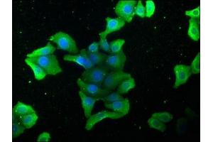 Immunofluorescence staining of HepG2 cells with ABIN7140126 at 1:168, counter-stained with DAPI. (STK4 Antikörper  (AA 6-24))