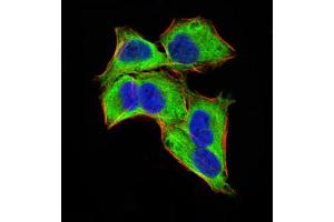 Immunocytochemistry (ICC) image for anti-Zinc Finger Protein GLI1 (GLI1) (AA 284-449) antibody (ABIN5866847) (GLI1 Antikörper  (AA 284-449))