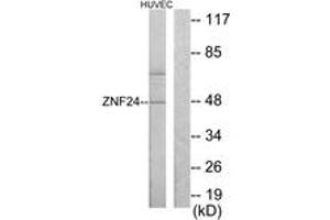 Western blot analysis of extracts from HuvEc cells, using ZNF24 Antibody.