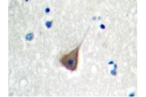 Image no. 2 for anti-Platelet Derived Growth Factor Subunit B (PDGFB) antibody (ABIN271781) (PDGFB Antikörper)