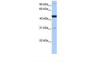 Image no. 1 for anti-Saccharopine Dehydrogenase (SCCPDH) (AA 316-365) antibody (ABIN6738887) (SCCPDH Antikörper  (AA 316-365))