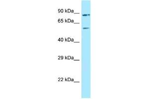 WB Suggested Anti-LRRFIP2 Antibody Titration: 1. (LRRFIP2 Antikörper  (C-Term))