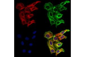 ABIN6261300 and ABIN6273226 staining Hela cells by IF/ICC.