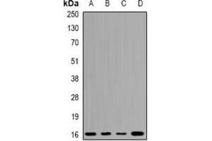 Western blot analysis of UBCH7 expression in A549 (A), K562 (B), mouse testis (C), mouse brain (D) whole cell lysates. (UBE2L3 Antikörper)