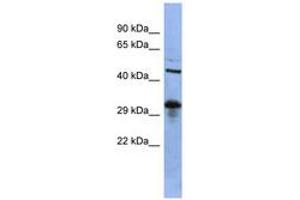 Image no. 1 for anti-SRY (Sex Determining Region Y)-Box 2 (SOX2) (C-Term) antibody (ABIN6742755) (SOX2 Antikörper  (C-Term))