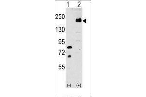 Image no. 1 for anti-Low Density Lipoprotein Receptor-Related Protein 6 (LRP6) (C-Term) antibody (ABIN358636) (LRP6 Antikörper  (C-Term))
