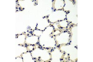 Immunohistochemistry (Paraffin-embedded Sections) (IHC (p)) image for anti-Polynucleotide Kinase 3'-Phosphatase (PNKP) (AA 60-320) antibody (ABIN6145836)