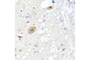 Immunohistochemistry of paraffin-embedded rat brain using FGF13 antibody (ABIN5975664) at dilution of 1/100 (40x lens). (FGF13 Antikörper)