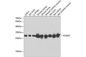 Western blot analysis of extracts of various cell lines using PGAM2 Polyclonal Antibody at dilution of 1:1000. (PGAM2 Antikörper)