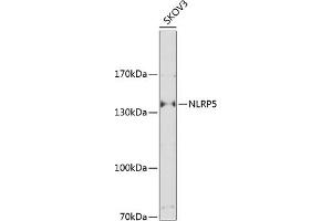Western blot analysis of extracts of SKOV3 cells, using NLRP5 Antibody (ABIN6131482, ABIN6144667, ABIN6144668 and ABIN6225229) at 1:1000 dilution. (NLRP5 Antikörper  (AA 157-256))